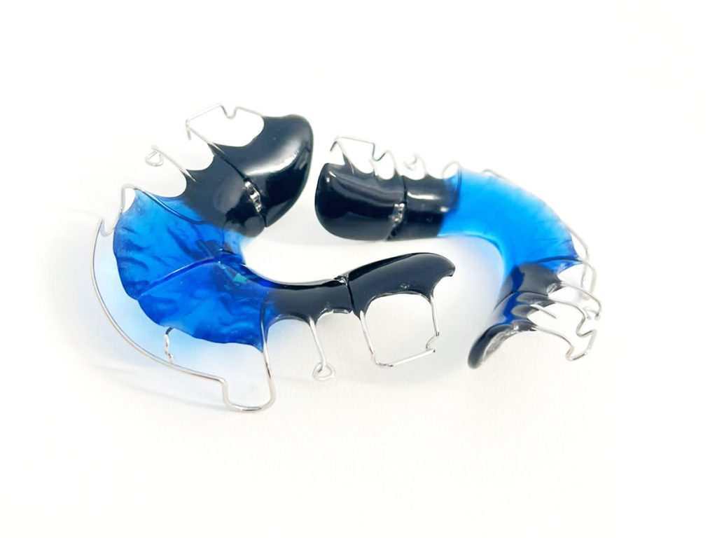 Herausnehmbare Zahnspange KFO Eckernförde